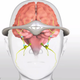 Illustration for article titled Migraine-Blasting Electric Headband Is Coming to The U.S.
